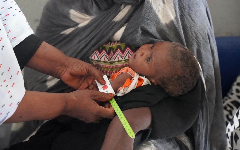 Sudan: Ein acht Monate altes Kind wird auf Mangelernährung untersucht. 