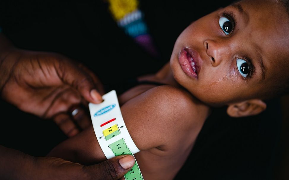 Mali: Der Arm eines Kindes wird mit einem Maßband gemessen.