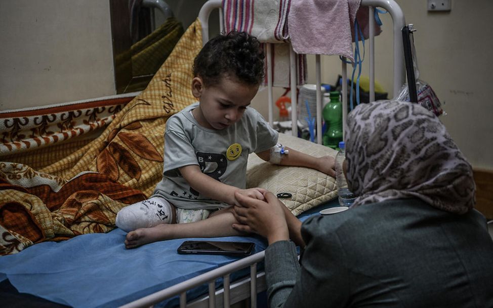 Kinder in Gaza: Ahmad (3) wurde bei einer Explosion am Bein verletzt. Sein Unterschenkel musste amputiert werden