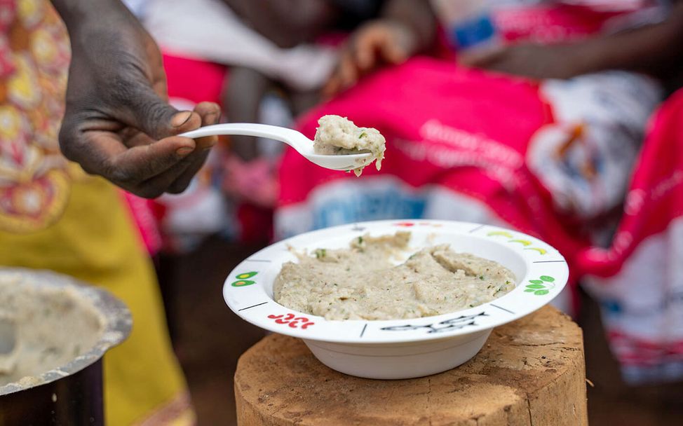 Mangelernährung: Viele Kinder weltweit brauchen spezielle Nahrung, um gesund zu bleiben. 