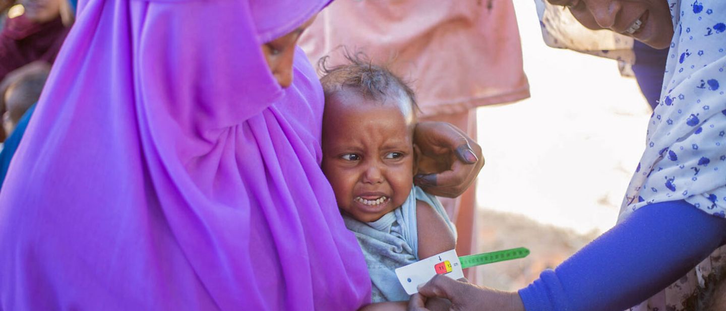 Sudan Spenden: Mangelernährte Kinder im Sudan und Nachbarländern brauchen Nahrung und Nothilfe. 