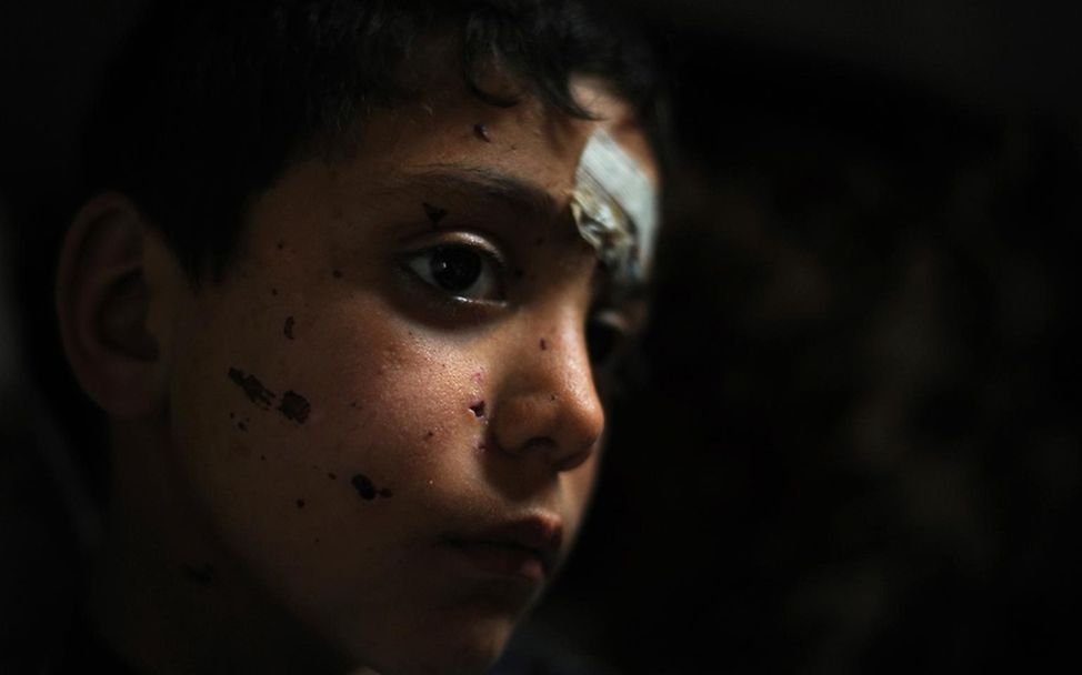 Verletzter syrischer Junge. ©UNICEF/NYHQ2012-0220/Brooks