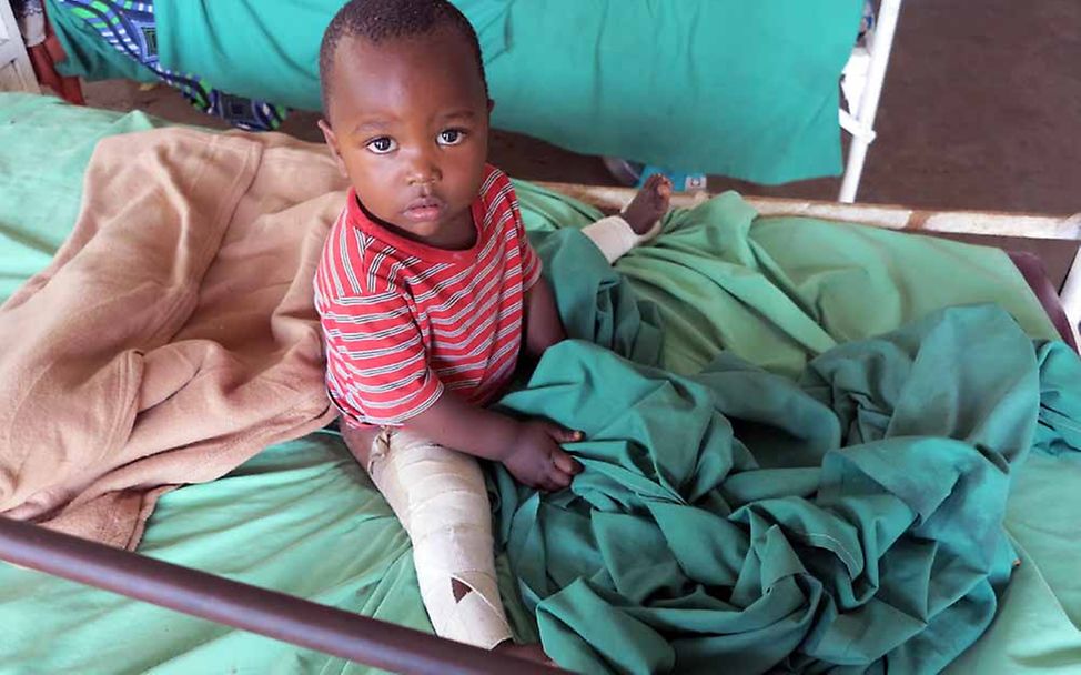Kongo: Ein Junge mit Hüftfehlstellung in einem Krankenhaus.