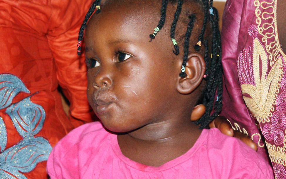 Ebola Sierra Leone: Die 2-jährige Issata hat überlebt