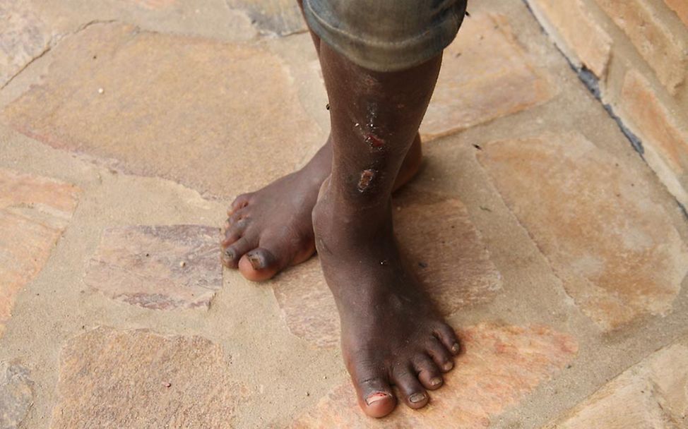Burundi Krise: Straßenkinder vor Gewalt schützen
