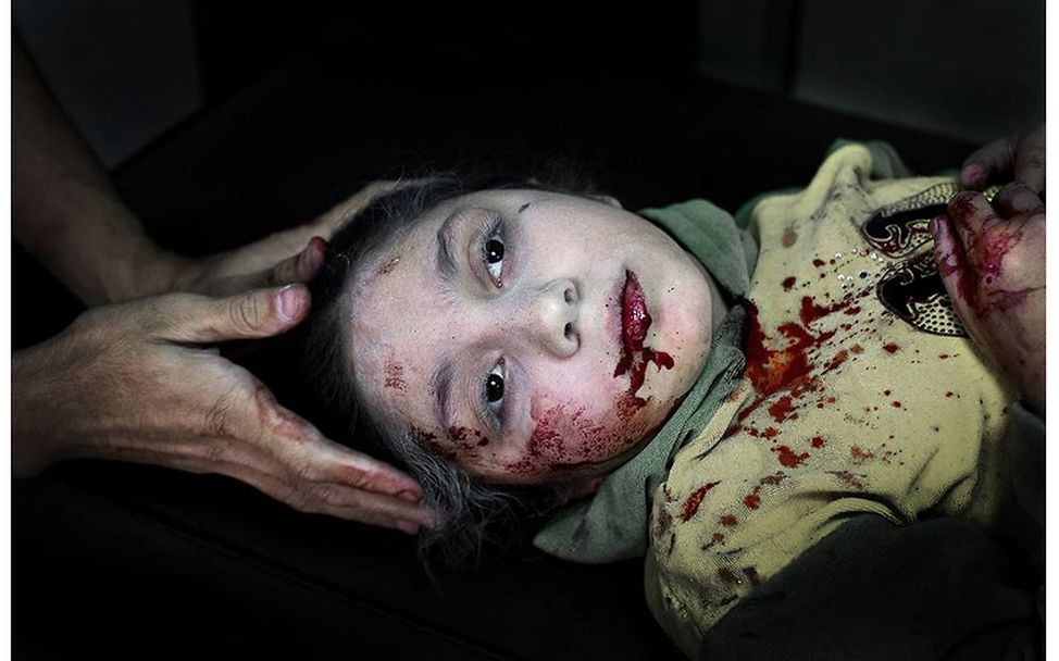 Syrien: Das vergessene Leid der Kinder. © Niclas Hammarström/Kontinent